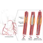 NHLBI_Fig02b_final03